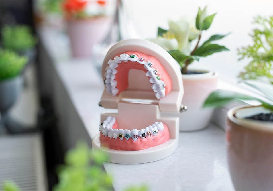 Top 5 Orthodontic Myths